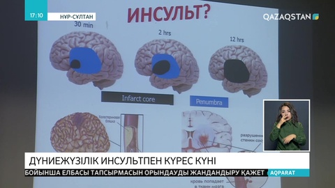 Елордада инсульттің алдын алу бойынша жиын өтті