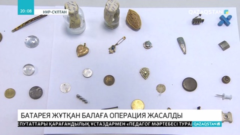 Бүгін батарея жұтып қойған 2 жастағы нәрестеге операция жасалды