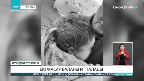 Атырауда 2 жастағы баланы ит талап тастады