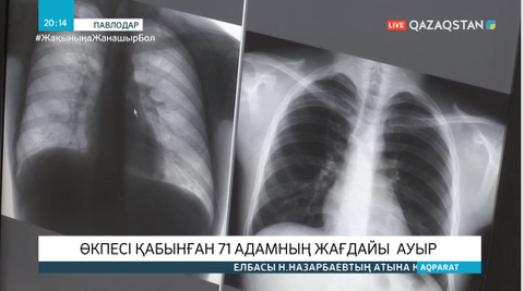 Түркістан облысында соңғы 23 күнде 23 адам пневмониядан қайтыс болды