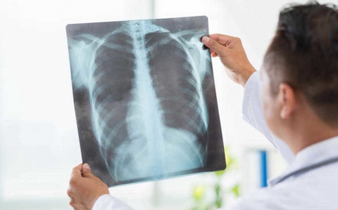 Пневмония коронавирус статистикасында неліктен есепке алынбайды?