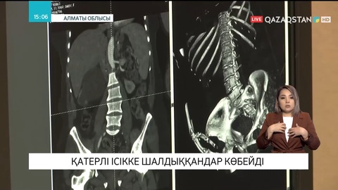 Алматы облысында қатерлі ісікке шалдыққандар көбейді