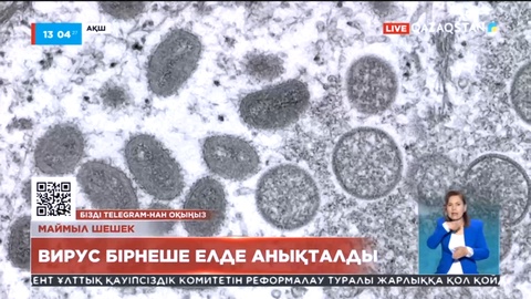 АҚШ-та бір тұрғыннан маймыл шешек ауруы анықталды