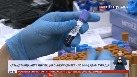 Қазақстанда АИТВ инфекциясын жұқтырған 30 мың адам тұрады