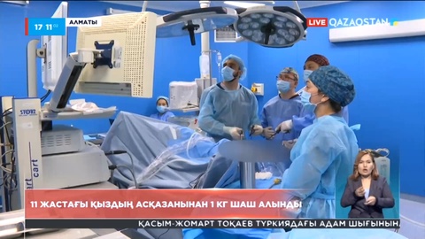 Алматыда 11 жастағы қыздың асқазанынан 1 кг шаш алынды