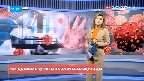 Ел аумағында 145 адам қызылша ауруымен тіркелді