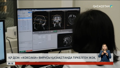 Министрлік: «Коксаки» вирусы Қазақстанда тіркелген жоқ