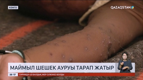 Африкада маймыл шешек ауруы тарап жатыр