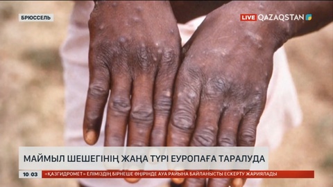 Маймыл шешегінің жаңа түрі Еуропаға таралуда