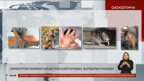 Денсаулық сақтау министрлігі маймыл шешегінен қорғанудың жолдарын ұсынды