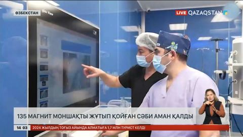 Өзбекстанда 135 моншақ жұтып қойған сәби аман қалды