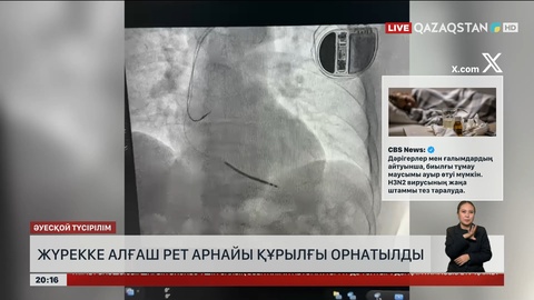  Алматыда жүрекке алғаш рет арнайы құрылғы орнатылды