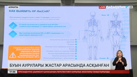 Жастар арасында буын аурулары көбейіп барады