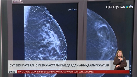 Елімізде сүт безі қатерлі ісігі 20 жастағы қыздардан анықталып жатыр