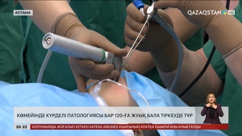 Көмейінде күрделі патологиясы бар 120-ға жуық бала тіркеуде тұр
