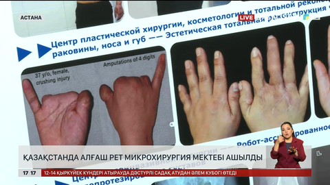 Қазақстанда микрохирургия мектебі бірінші рет ашылды