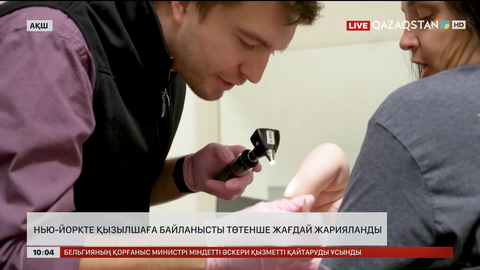 Нью-Йоркте қызылшаға байланысты төтенше жағдай жарияланды