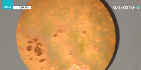 Қазақ ғалымдары терінің зең ауруларын емдейтін дәрі ойлап тапты