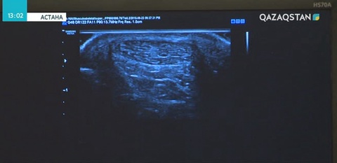 Астанада VII Еуразиялық радиологиялық форумы өтті