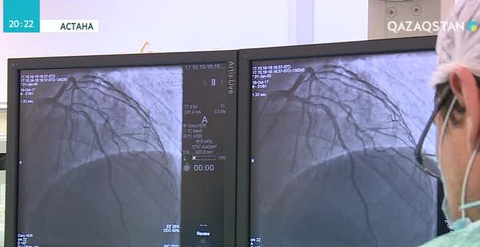 Қан тамырларына заманауи стент қою бойынша тұңғыш операция жасалды