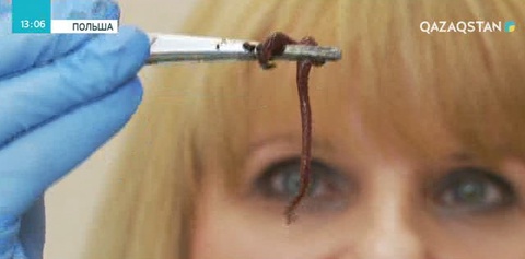 Жауын құрттары келешекте қатерлі ісікті емдеуге пайдаланылуы мүмкін