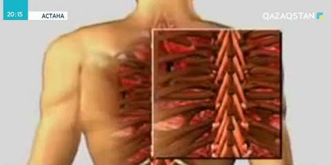 Қазақстандағы әр екінші баланың омыртқа жотасы қисық