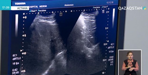 Ертеңнен бастап медициналық ұйымдарында ашық есік күні басталады