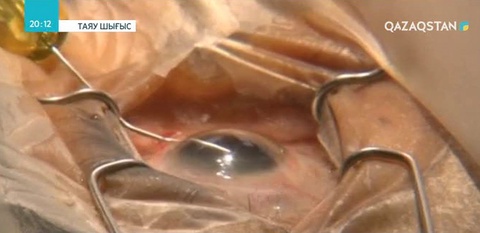 Израильде көзге арналған «Нано» тамшылар жасалды