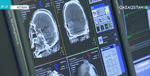 Тегін медицинаның мүмкіндіктері көп