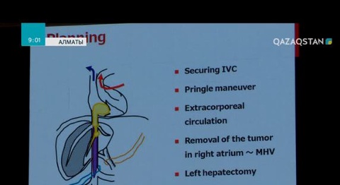 Елімізде ішкі ағзалардың доноры тапшы