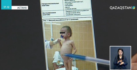 Елімізде 7 мыңдай адам 60 түрлі сирек кездесетін ауруға шалдыққан