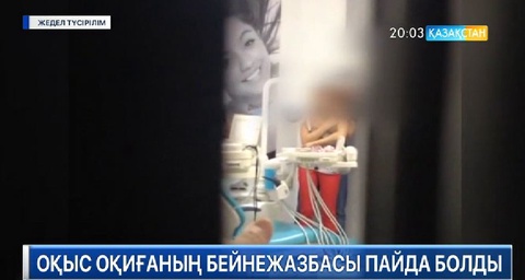 Тіс емханасындағы оқиғаның бейнежазбасы пайда болды