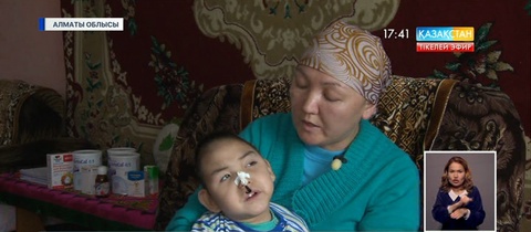 Ми дертіне шалдыққан 5 жасар Нұрбекке көмек керек