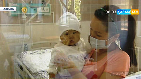 А.Сызғанов атындағы Ұлттық хирургия ғылыми орталығында екі баланың бауырына трансплантация жасалды