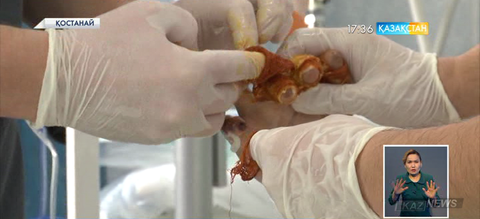 Қостанайда петардаға ұқсас жарылғыш заттан 4 бала зардап шекті