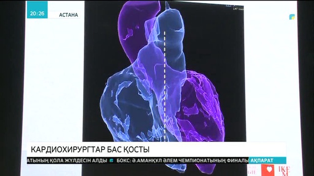 Астанада алғаш рет кардиохирургтар конгресі өтуде