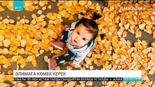 Сирек кездесетін ауруға шалдыққан 1,5 жастағы Әлима көмекке мұқтаж