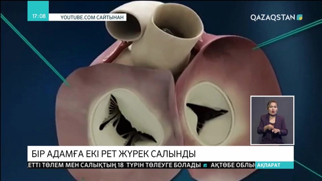 Әлем бойынша Қазақстанда тұңғыш рет бірегей операция жасалды