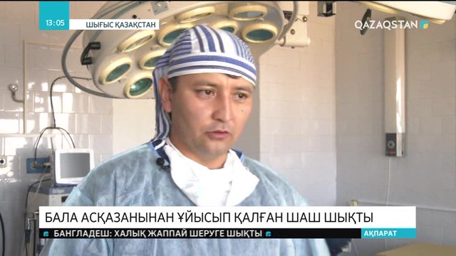 Шығыс Қазақстанда бала асқазанынан ұйысып қалған шаш шықты