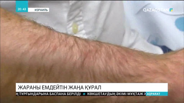 Израильде күйік пен жараны емдейтін құрылғы жасалды