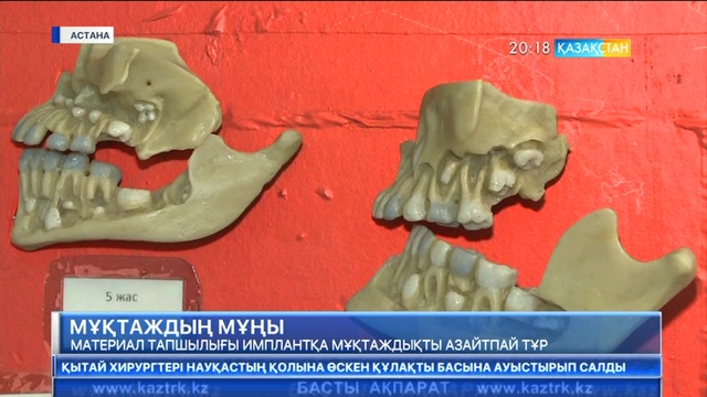 Қазақстандық мамандар 3D принтердің көмегімен түрлі импланттарды басып шығаруға дайын