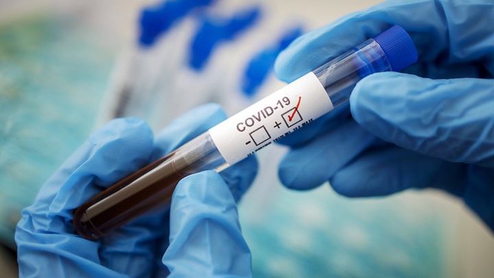 Бір күнде 739 адамнан коронавирус анықталды