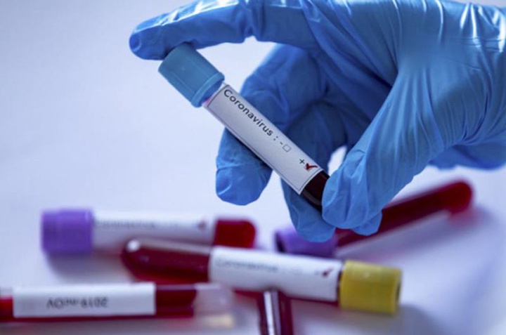 Қырғызстанда алғаш коронавирус жұқтырғандар тіркелді