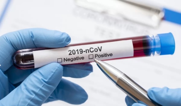 Қазақстандық кәсіпкерлер коронавируспен күреске қаражат бөліп жатыр