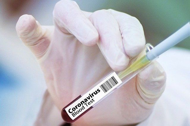 Елордалықтар COVID-19-ға тегін тест тапсыру үшін не істеуі керек?