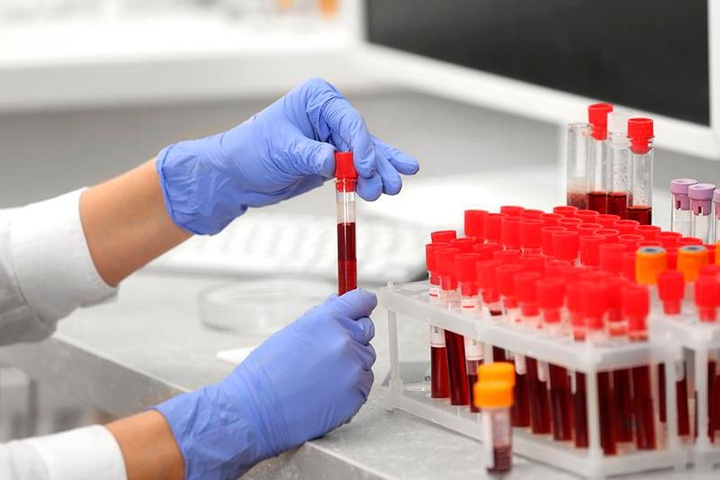 Коронавирусқа қарсы вакцина клиникалық сынақтан қашан өтеді?