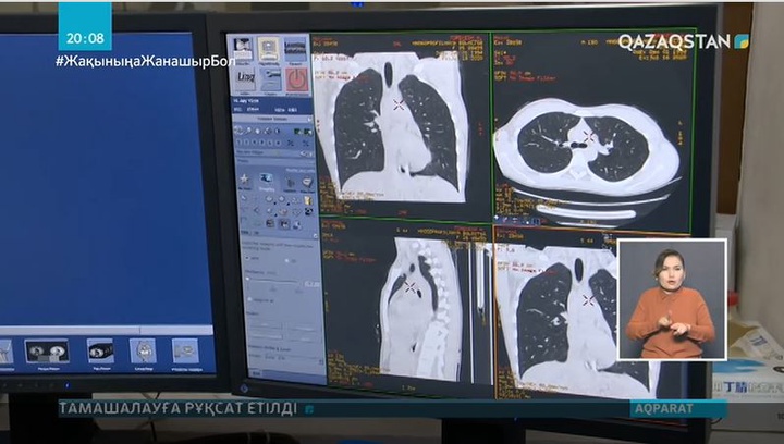 Коронавирус жұқтырғандарды емдеудің жаңа бағдарламасы жасалады