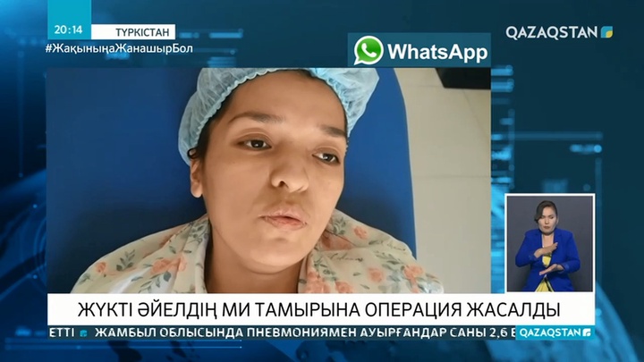 Жүкті әйелдің ми тамырына операция жасалды