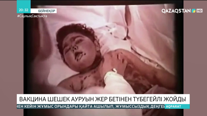 Вакцина шешек ауруын жер бетінен түбегейлі жойды