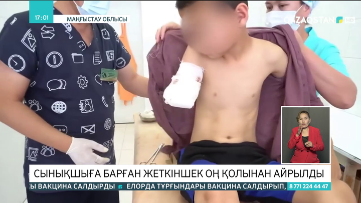 Сынықшыға барған жеткіншек оң қолынан айырылды